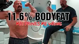 Brain Shaw 11.6% || MRI Proves Me Wrong
