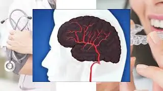 Hidden Heart Danger Why Tooth Loss Might Signal Cardiovascular Risk