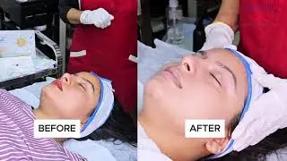 D-Tan Korean Facial With & Without Hydrafacial | How To Use | A+ Professional Range