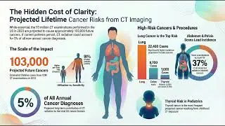 Projected Lifetime Cancer Risks From CT Imaging: A Population-Level Risk Modeling Analysis-Podcast