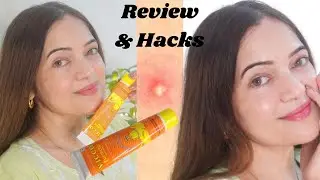 VICCO TURMERIC CREAM REVIEW in HINDI/URDU | विक्को टरमेरिक क्रीम |उपयोग और हैक्स | (REQUESTED)