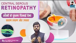 What is Central Serous Retinopathy ? || Symptoms, Diagnosis & Treatment