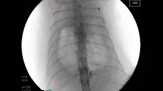 Cat with pleural effusion ( hydrothorax ) Fluorscopy wiev x-ray