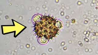 10 Bláznivých Věcí Spatřených Pod Mikroskopem