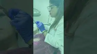 CO2 Lasers | DPN and Freckles | Dhaka Dermatology Institute | LaserTreat