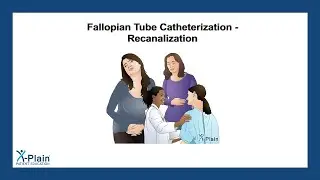 Fallopian Tube Catheterization - Recanalization