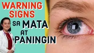 Warning Signs na May Problema sa Mata at Paningin - By Doc Liza Ramoso-Ong
