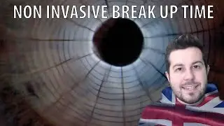 Non Invasive Break Up Time - tear Film Evaluation #4 [ENG]