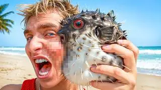 I Was STUNG By PUFFERFISH!! *Major Allergic Reaction*