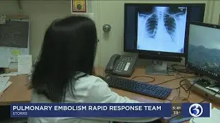 UConn Health's Pulmonary Embolism Rapid Response Tea