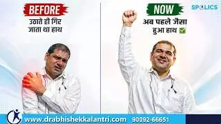 Rotator Cuff Tear Surgery Success Story | Real Patient | कंधे की गंभीर चोट से पूरी रिकवरी