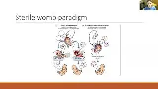 Oral Project 2_Early gut microbiome development