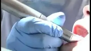 Children's Dental education