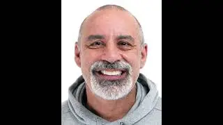 Full Arch Dental Implants - Glenferrie Dental