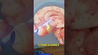 La lobotom&iacute;a picahielo