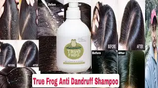 True Frog Anti Dandruff Shampoo Review