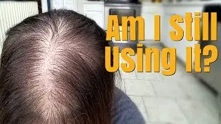 #gofybr #alopecia #hairloss   My hair loss update! | Gofybr Demo | Dark Brown