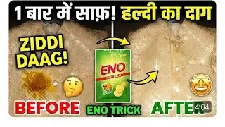 Haldi Ka Daag Kaise Hataye? | ENO & Vinegar Trick | White Kapde Safed