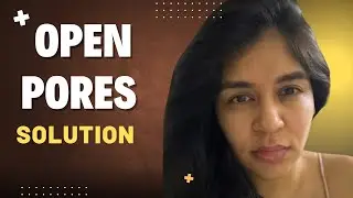 Open Pores Solution by Dermatologist | Microneedling | 9999 747 717