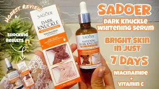 Bright skin in just 7 days 😱 | Sadoer dark knuckle whitening serum | Non Sponsored