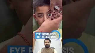 Artificial Eye Transformation | Eye Prosthesis & Life-Changing Eye Replacement