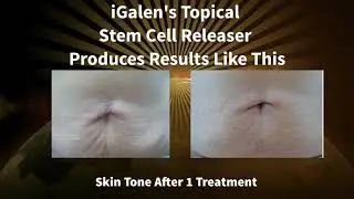 Stem Cells Game Changer 2