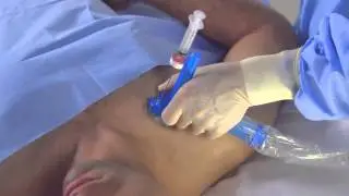 Part 2: Axotrack Tips - Subclavian Vein Central Venous Access