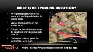 Basics of Epidural Steroid Injections from a Phoenix pain management center (602) 507-6550