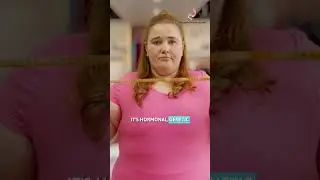 The Truth About Obesity It&rsquo;s NOT Your Fault #weightlosssurgery #bariatricsurgery