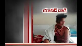 Man Attacked by Angry Lover with Acid | After Rejects Marriage Proposal | at Pedda Kottala
