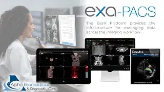 Exa PACS: PACS Web Zero Footprint + Server-Side Rendering | Flujo de Imagen M&eacute;dica KONICA MINOLTA