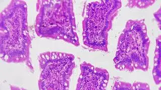 Cross section of small intestine magnified under microscope in 200 times on bright field