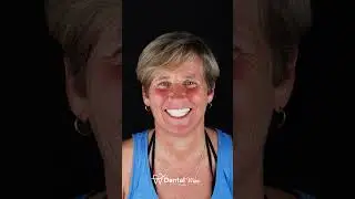 Protect your smile today. #dentist #smiledesigndental #smilemakeoverturkey