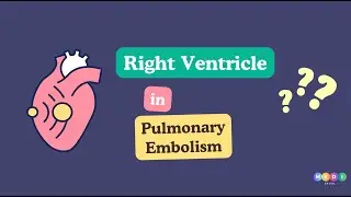Pulmonary Embolism and The Right Ventricle