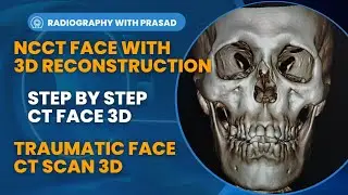 NCCT Face with 3D Reconstruction || How to do CT Scan of Face with 3D; Step-by-Step || Prasad Layek