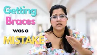 Are Retainers for Lifetime ?! *The Answer Will Shock You* | Manya Agrawal