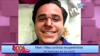 Mario V&eacute;lez contin&uacute;a recuper&aacute;ndose de lesiones en su nariz