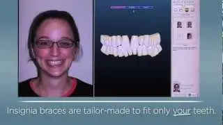 Denver Orthodontist | (303) 758-5858