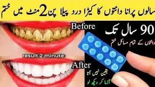 This secret remedy will make your yellow &dirty teeth shine like pearl for 80 years 👈