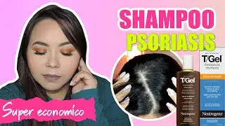 PSORIASIS en el cuero cabelludo - Shampoo económico que SI ME FUNCIONÓ