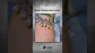 Clinical case | What's This Procedure Names ? #nursingquiz #nursing #shorts #nursingpreparation