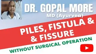 🚑 Best Piles, Fistula & Fissure Treatment in Bhubaneswar | Without Surgery | Dr. Gopal More Clinic