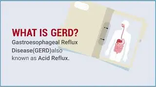 Awareness Video on GERD - Also know as Acud reflux
