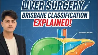 Brisbane classification, Haemobilia, Bilhaemia, Hydatid cyst, Liver abscess | Lecture#37 | Surgery