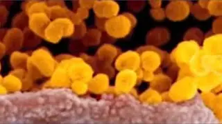 WHO names novel coronavirus COVID-19
