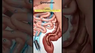How Doctors See Inside Your Colon: Modern Medical Technology Explained | Bio Anatomy Art |Gut Health