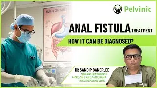 What is the Treatment for Anal Fistula & How is it Diagnosed? | Complete Guide