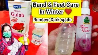 How To Get Rid Of Dry , Dull And Sun Tan In Winter || Hand And Feet Care...\\Shafaq Hussnain World\\
