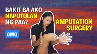 The HARDEST DECISION that I made in MY LIFE | Amputation - Cherry Ramos