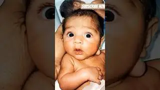 Wonderfull eyes reaction 🥰🥰🥰🥰 New born ❤️❤️❤️#neonatologist #newbornbaby #shorts #baby